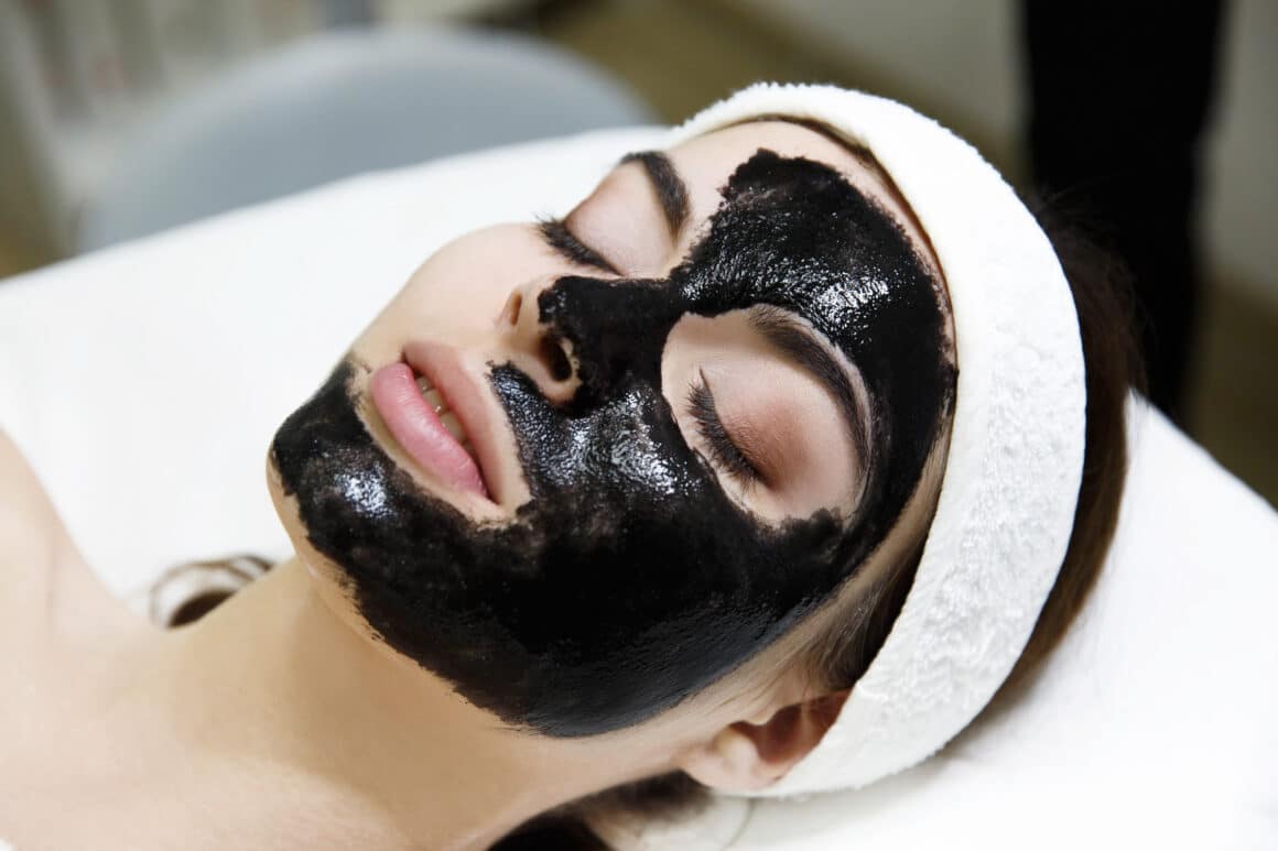 How Chemical Peels Help in Treating Acne and Scarring