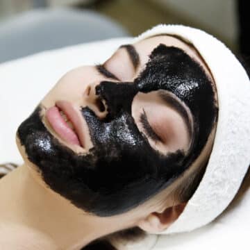 How Chemical Peels Help in Treating Acne and Scarring