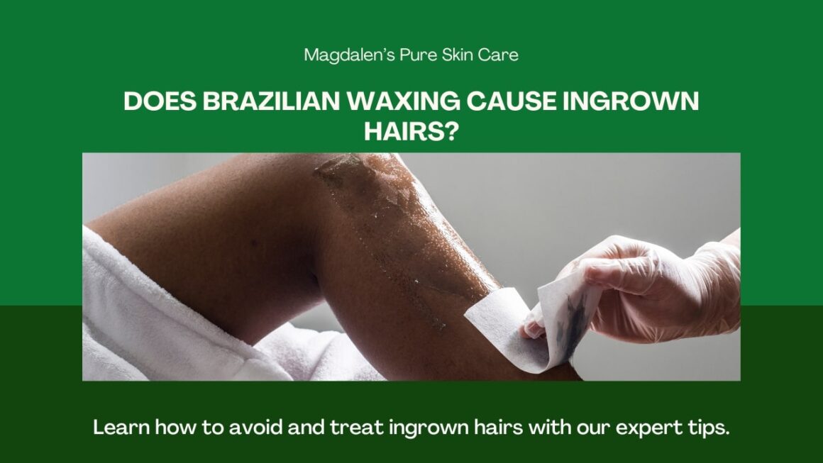Does Brazilian Waxing Cause Ingrown Hairs?