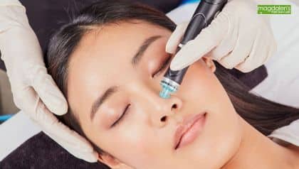 HydraFacial treatment in Rockville, MD, for deep cleansing, exfoliation, and glowing skin