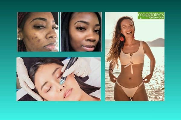 Professional waxing and skincare services, including Brazilian wax, facials, chemical peels, and HydraFacial treatments in Rockville, MD.